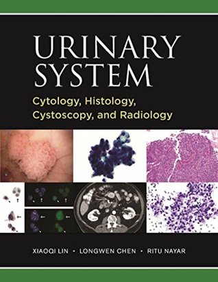 Download Urinary System: Cytology, Histology, Cystoscopy, and Radiology - Xiaoqi Lin MD PhD file in PDF